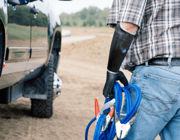 Returning to Work After Upper Limb Amputation