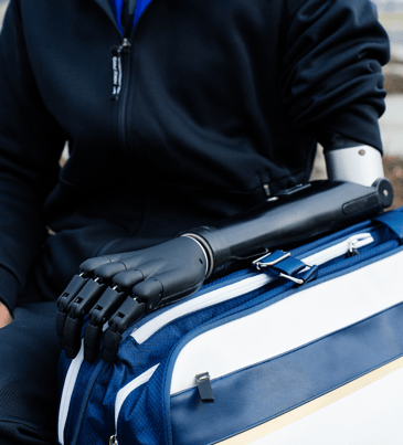 7 Life-Changing Rehabilitation Stages for Amputees with Upper Limb Loss