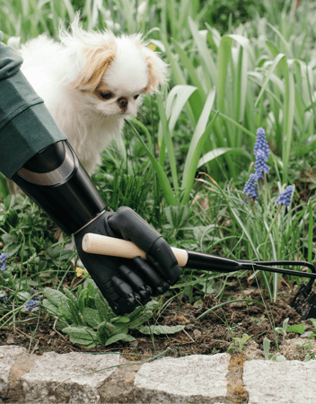 What to Know Before Getting a Bionic Hand