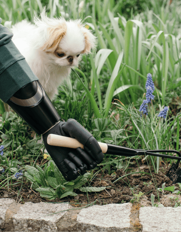 What to Know Before Getting a Bionic Hand