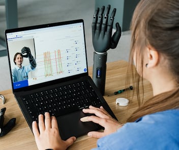 Typing and Texting with an Upper Limb Prosthesis