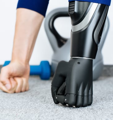 Bionics vs Prosthetics